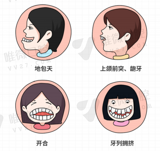 种植牙奥齿泰加强是什么（奥齿泰携带体是什么）(图1)